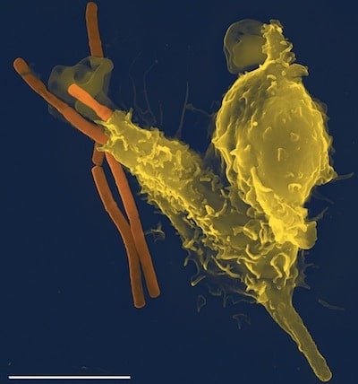 імунна система