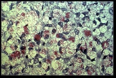 імунна система