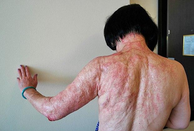 Напалм у В'єтнамі