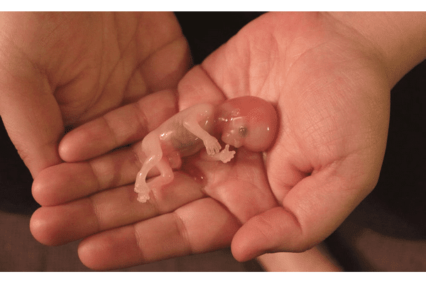 аборти статистика