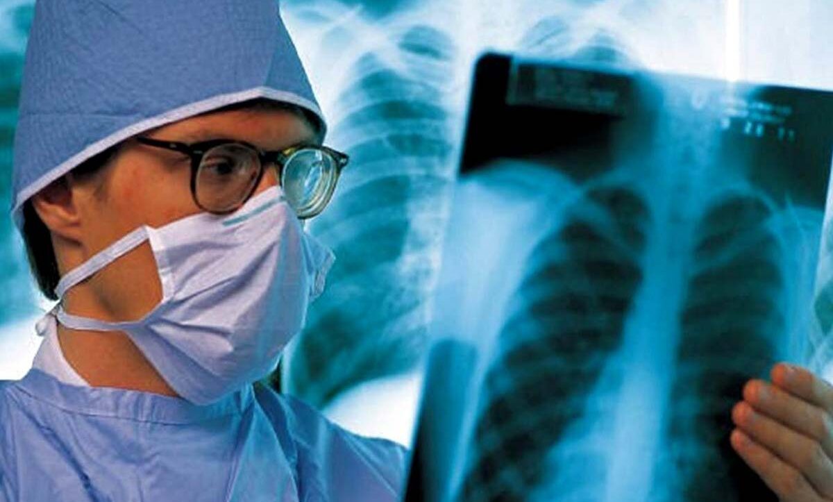 захворювання на туберкульоз