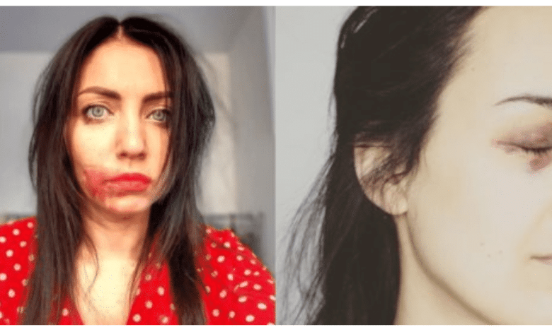 ратифікувати Стамбульську конвенцію