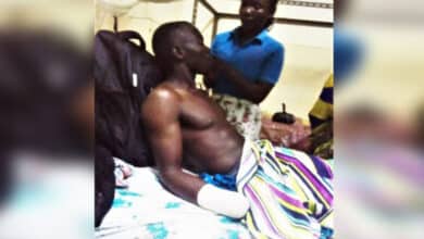 відрубали руку