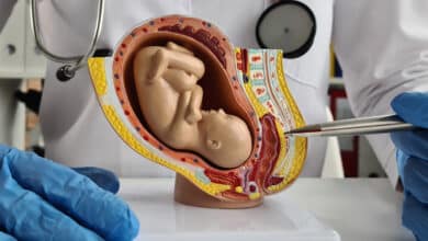 аборти є основною причиною смертності