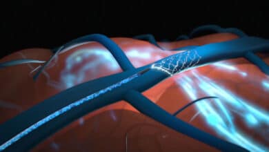 випробуваня мозкового чипа