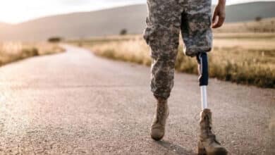 протезування українців