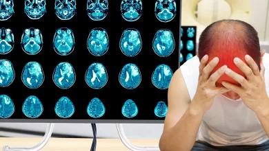 неврологічні захворювання