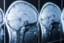 Мікропластик під мікроскопом — загроза для здоров’я людини