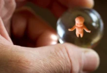 Понад 73 млн абортів у світі за рік: аборт як головна причина смертності